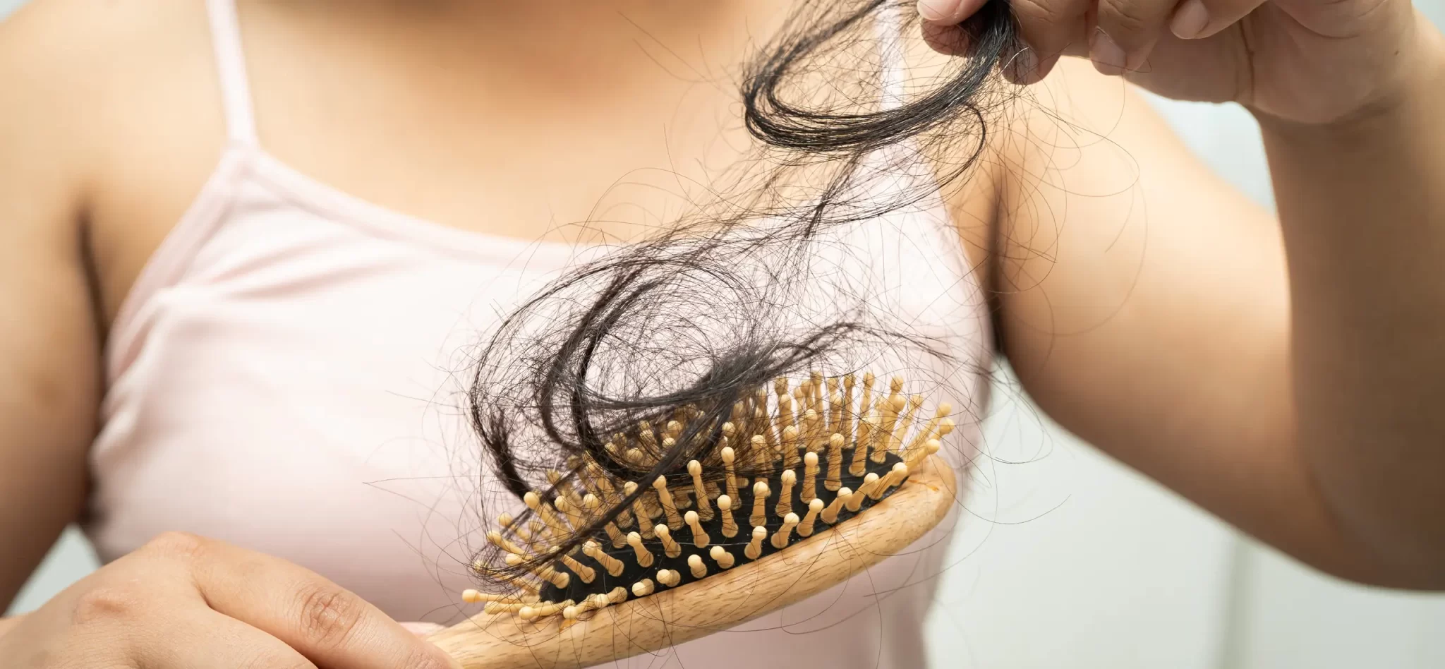 Hair loss and Mounjaro